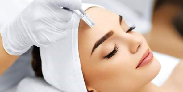 Nieuw in de salon microneedling